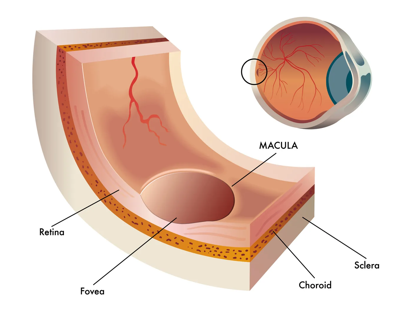 Macula Degeneration