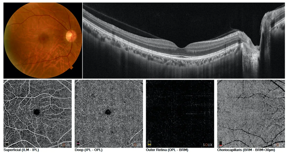 - eye clinic