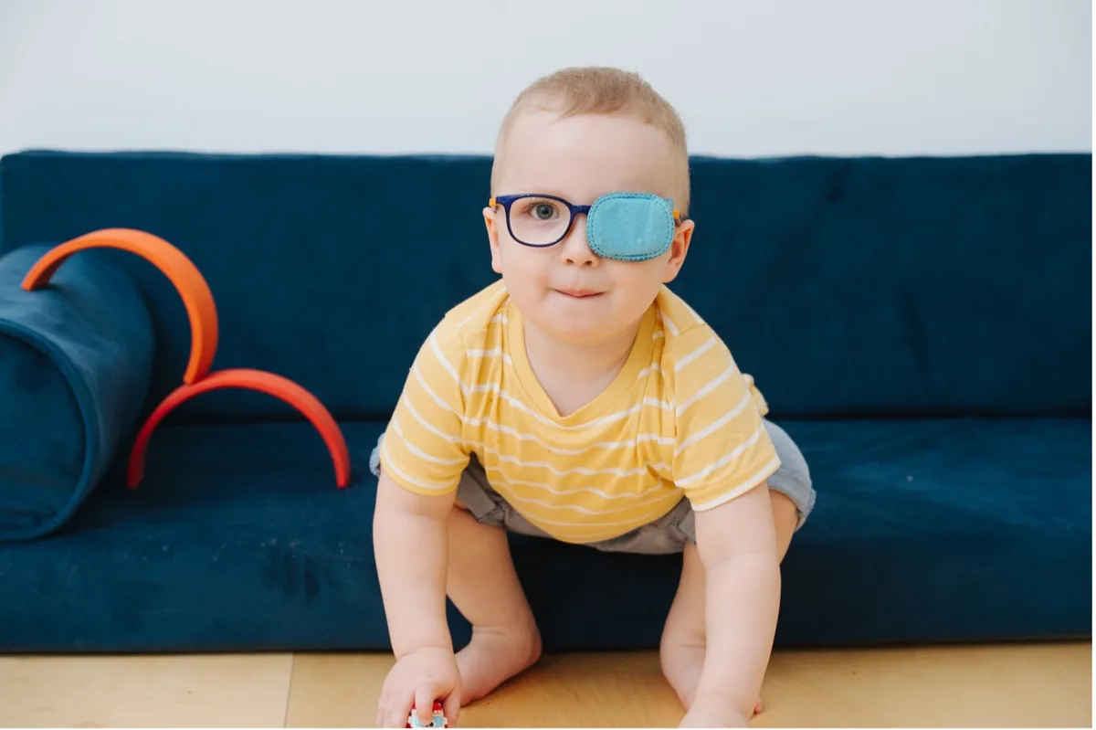 A toddler wearing glasses with a patch over the stronger eye to treat amblyopia