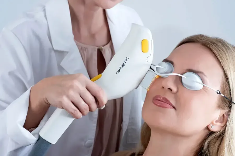 The Lumenis OptiLight IPL platform used at the clinic