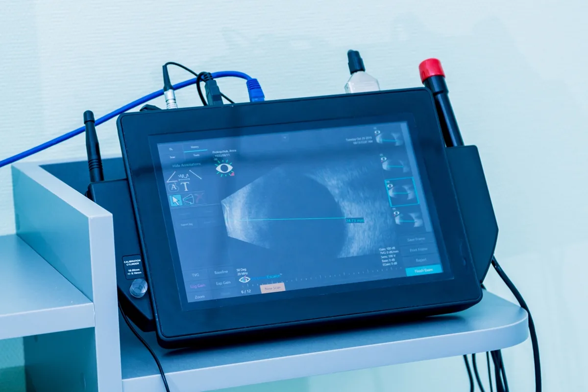 An ocular ultrasound scan displayed on the machine