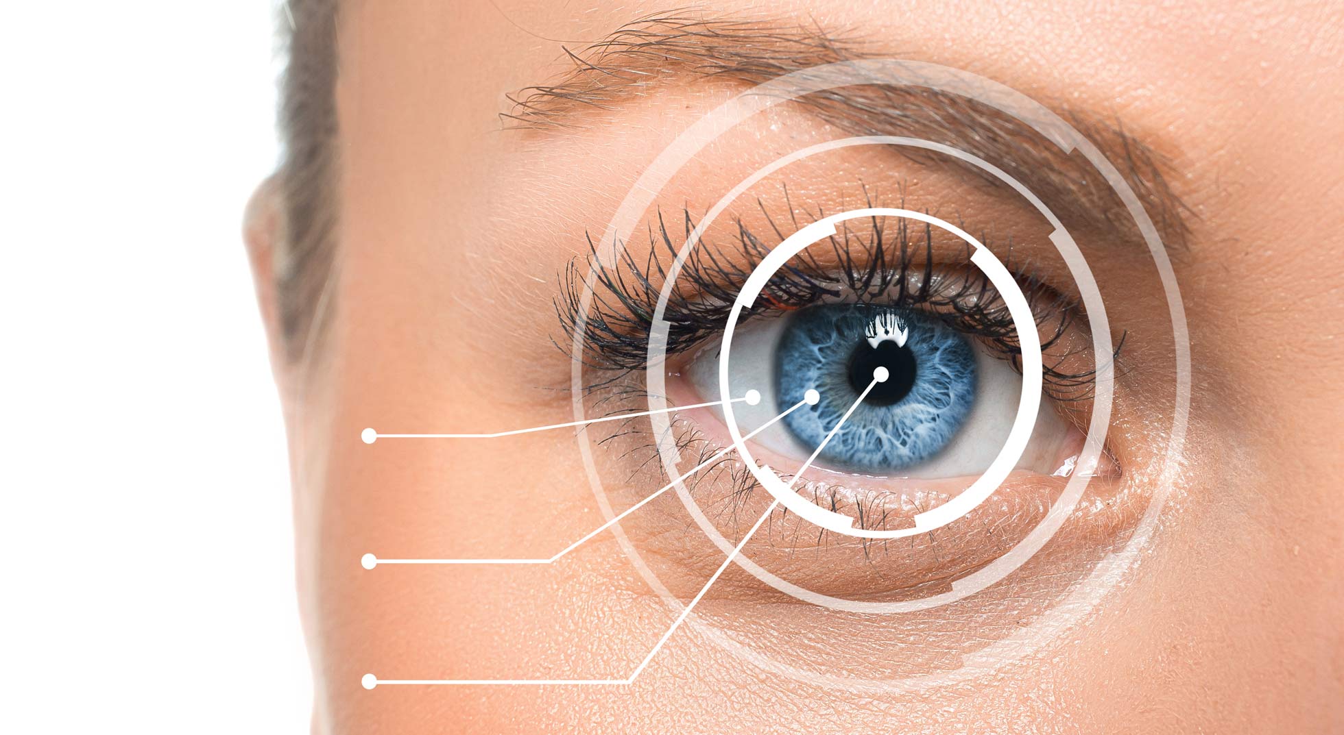 Femto Laser LASIK - eye clinic