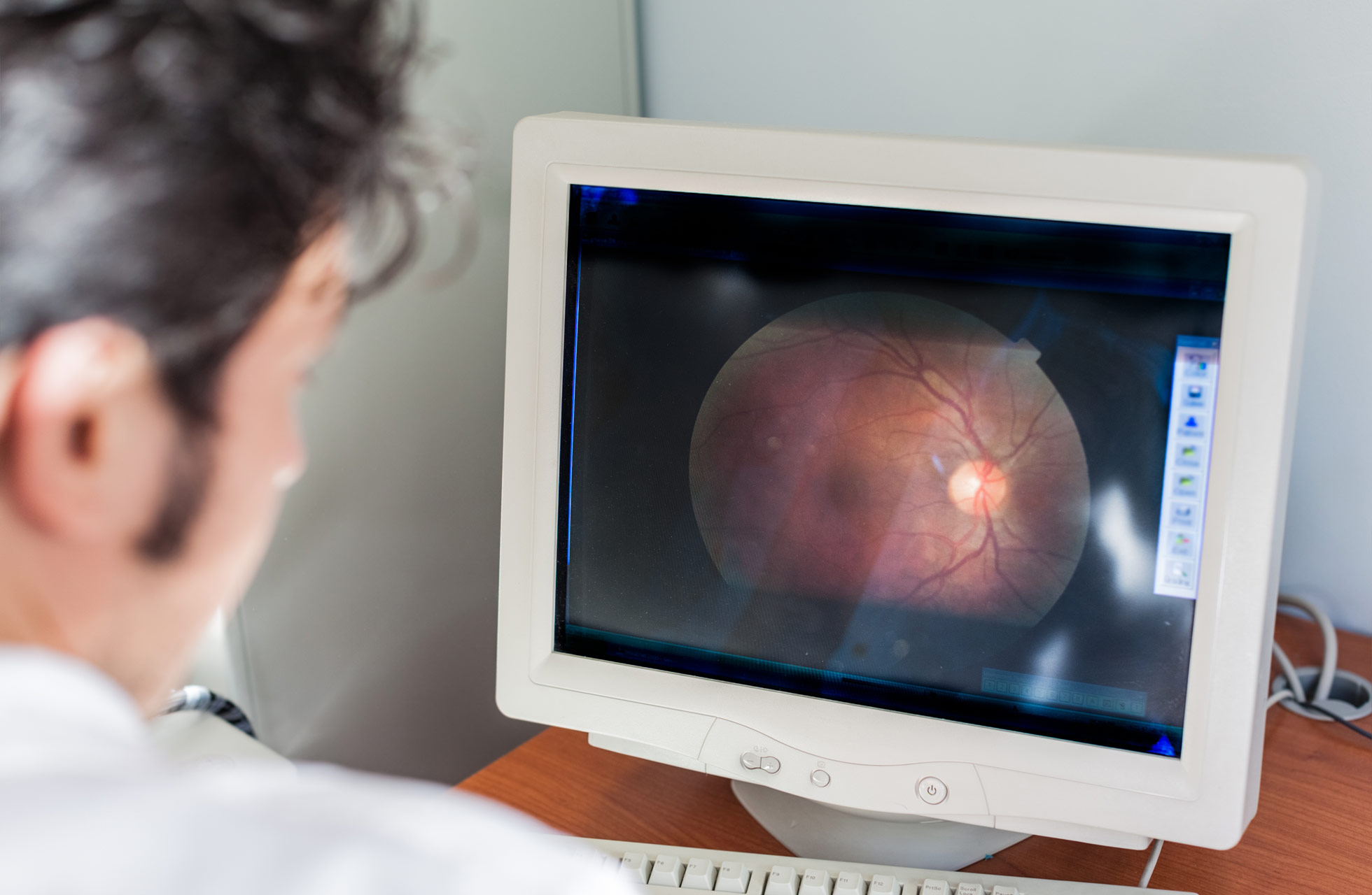 Θεραπεία Μυοψιών με Laser - eye clinic